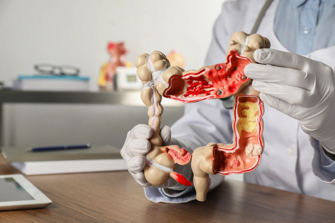 Gastroenterología
